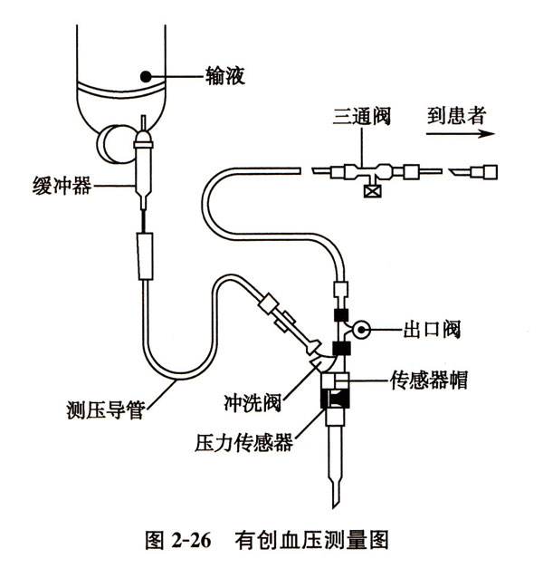 矢量血压测量仪器图