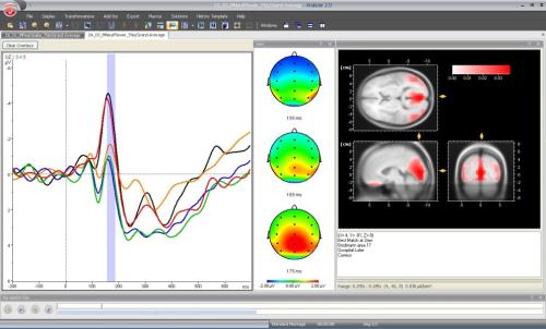i2Brain