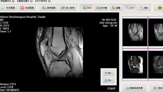 eFilmDICOMDump医学图像浏览器