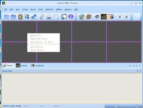 Sante MRI Viewer